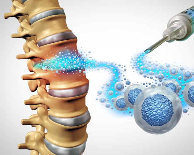 minimally invasive spine